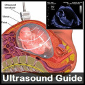 Ultrasound Guide