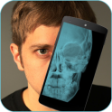 Skull X-ray Prank