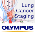 Lung Cancer Staging Table