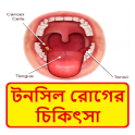 টনসিল রোগের চিকিৎসা ~ Tonsil Disease Treatment