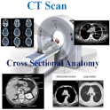 CT Scan Cross Sectional Anatomy
