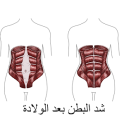 شد البطن بعد الولادة