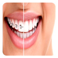 Orthodontic Guide