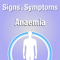 Signs & Symptoms Anaemia