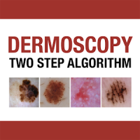 Dermoscopy Two Step Algorithm
