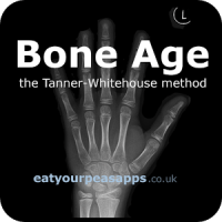 Bone Age