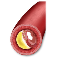 Cholesterol Guide