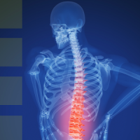 Back Pain & How To Prevent It