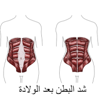 شد البطن بعد الولادة