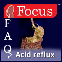 FAQs in Acid Reflux